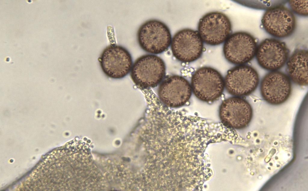 Physarum auriscalpium?